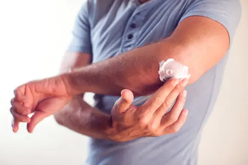 photo of man putting on lotion